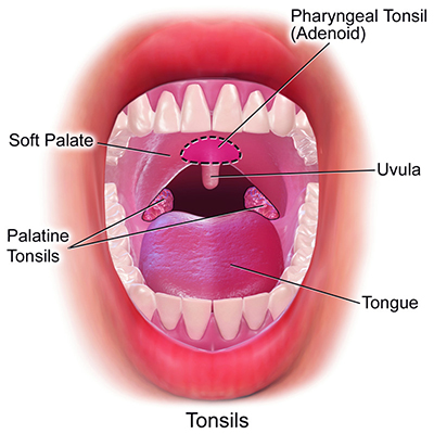 tonsils & adenoids