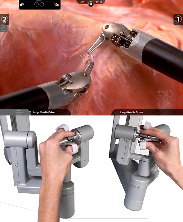 da Vinci Surgical System how it works