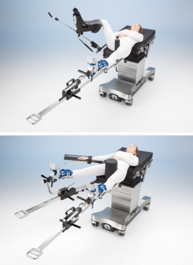 Flexion orthopedic operating table