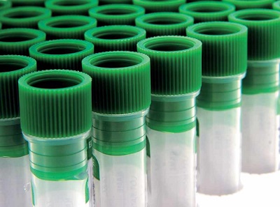 PolyOne acquires Kraton TPE assets
