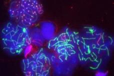 Non-BRCA carriers continue to have more screenings they may not need