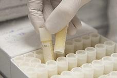 Diet, urine acidity may affect susceptibility to UTIs