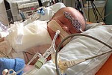 3D printed devices save baby’s life