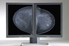 Display System for Breast Tomosynthesis