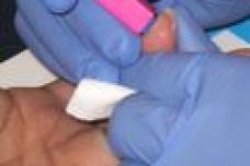 Statin use linked to few side effects