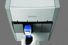 WHO-endorsed tubercolis test offers rapid detection