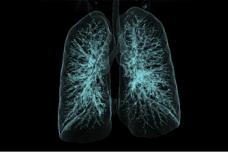 Jury, public choose best CT images in ‘right dose’ contest