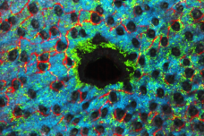 Technological breakthrough for skin regeneration