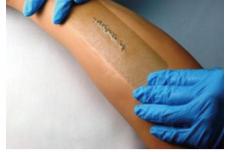 Antimicrobial silicone wound dressing