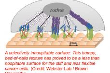 Breast implant deters cancer cells