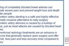 Stenting blocked bowel arteries saves lives