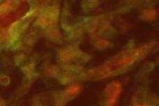 Growing better vessels could keep tissues alive