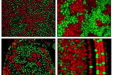 Seeing X chromosomes in a new light