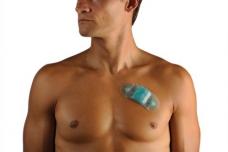 Novel New Device to Diagnose Irregular Heart Beat