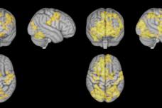 Researchers study brain activity during meditation