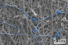 Electrically spun fabric offers dual defence against pregnancy, HIV
