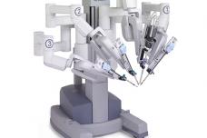 Robotic lobectomy for tumor removal