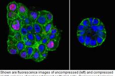 To revert breast cancer cells, give them the squeeze