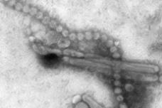 Human H7N9 case confirmed in Hong Kong
