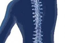 Mobility technology next big thing in spinal surgery devices