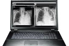 World's First Mobile Radiology Reading Station