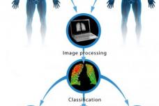 New CT technique differentiates types of lung damage