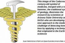 Earlier detection of bone loss may be in future