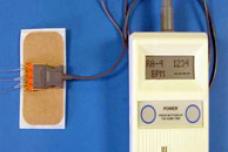 Device helps ALS patient to breathe without ventilator