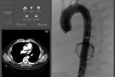 Patient simulation technology gets US patent