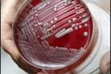 Hospital cleaning protocol ineffective against MDR bacteria