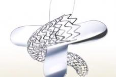 Stent demonstrates low event rates through three years