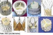New aortic valve devices may hold the key to your heart