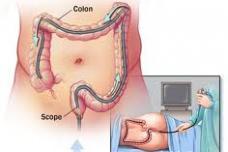 Brief class on easy-to-miss precancerous polyps ups detection