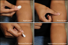 Flu vaccine patches may be future of immunization