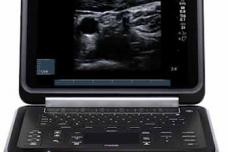 Product of the Week: Edge (SonoSite)