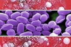 U.S. shipped anthrax spores overseas