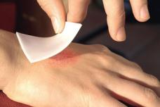 Raw Materials for Wound Dressings