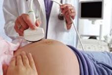 Ultrasound detects second trimester markers <br>for Down's syndrome