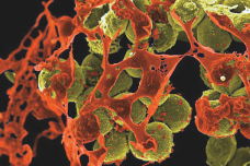 US budget cuts slash into fight vs superbugs