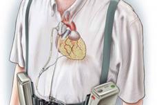 HEART ASSISTANCE SYSTEM