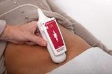 FDA clears Vitacon’s bladder scanner