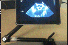 3D tool helps visualize cardiac anatomy