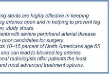 Drug-coated stents prevent leg amputation