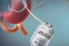 Social networking implant for weight loss