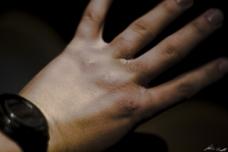 Beauty, not disease, motivates teens to wear sunscreen