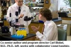 Researchers eye new target for rheumatoid arthritis drugs