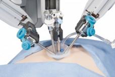 Sinai Hospital surgeon performs scarless gallbladder surgery
